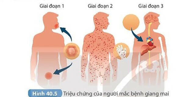 Lý thuyết KHTN 8 Bài 40 (Kết nối tri thức): Sinh sản ở người (ảnh 1)