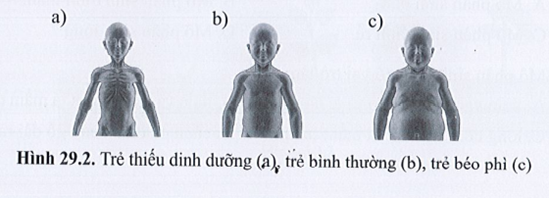 SBT Khoa học tự nhiên 7 Bài 29: Khái quát về sinh trưởng và phát triển ở sinh vật - Cánh diều (ảnh 1)