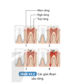 Làm việc nhóm để thực hiện các yêu cầu sau: Quan sát Hình 32.2, thảo luận về các giai đoạn 