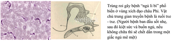 Sưu tầm thông tin, tranh ảnh về một số bệnh do nguyên sinh vật gây nên 