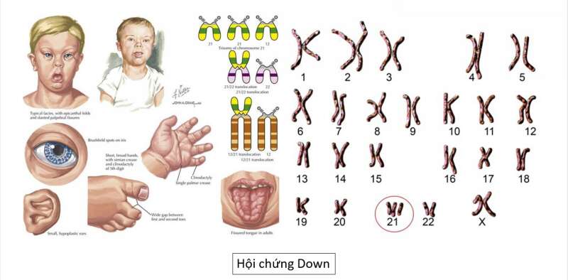 Lý thuyết Sinh học 10 Bài 17 (Kết nối tri thức): Giảm phân (ảnh 5)