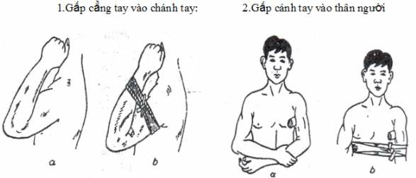 Giáo dục quốc phòng 11 Bài 7 (Lý thuyết và trắc nghiệm): Kĩ thuật cấp cứu và chuyển thương (ảnh 2)