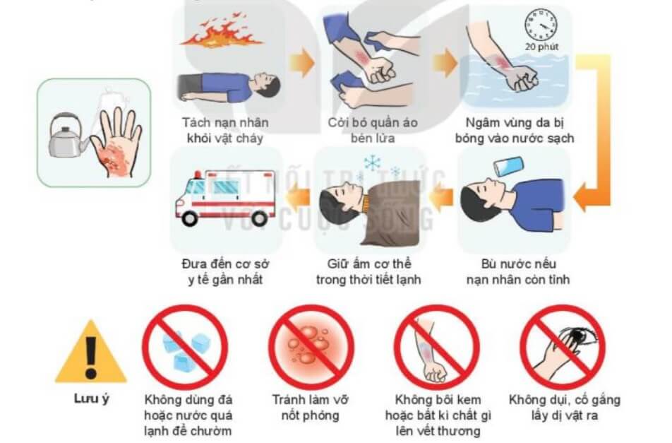 Lý thuyết GDQP 10 Kết nối tri thức Bài 12: Kĩ thuật cấp cứu và chuyển thương