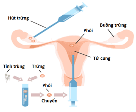 Lý thuyết Sinh học 11 Bài 47: Điều khiển sinh sản ở động vật và sinh đẻ có kế hoạch ở người | Lý thuyết Sinh học 11 đầy đủ, chi tiết nhất