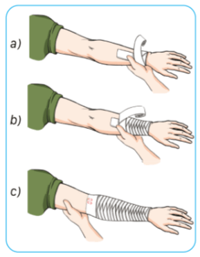 Trắc nghiệm GDQP 10 Cánh diều Bài 2 (có đáp án): Kĩ thuật cấp cứu và chuyển thương