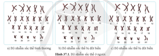 Quan sát hình 37.1, cho biết hình 37.1b và 37.1c có gì khác so với hình 37.1a về cấu trúc và số lượng